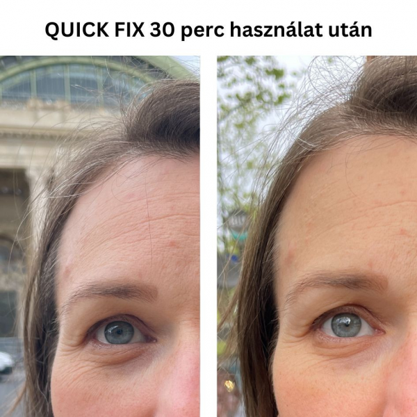 QUICK FIX szemkörnyékápoló azonnali b.o.t.o.x hatású peptiddel 15ml - Image 4